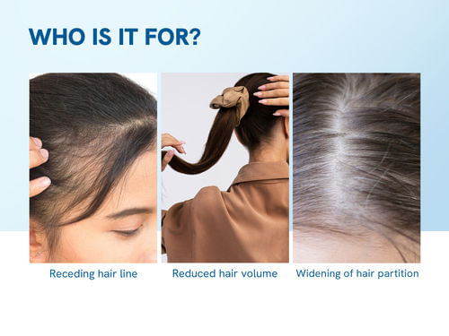 Hair Growth Serum Roll‑On