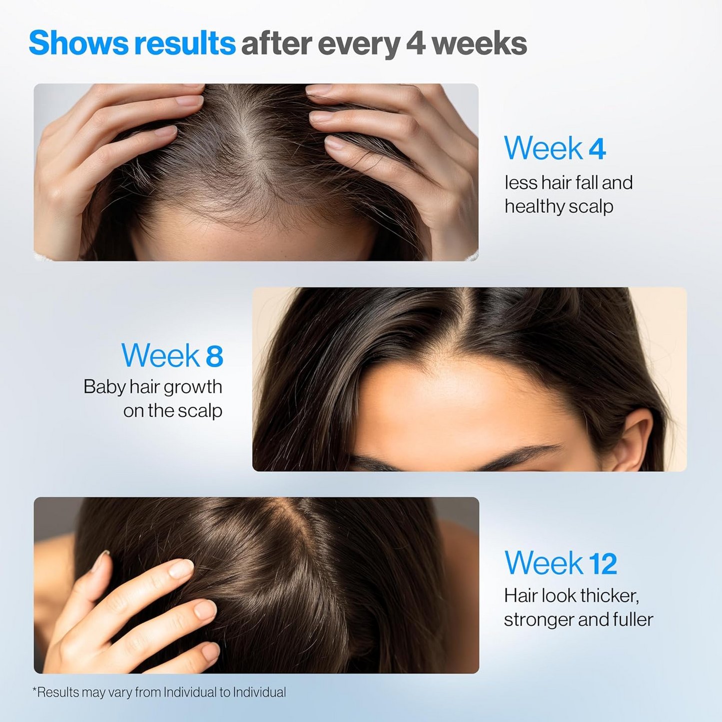 Be Bodywise Rosemary Hair Growth Serum Roll On 25 ml – 3% Rosemary, 3% Redensyl & 2% Anagain | DHT-Blocking Scalp Serum Boosts Oxygen Flow, Reduces Hair Fall | Paraben/Sulfate-Free | Women & Men