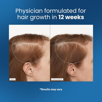 Hair Growth Serum Roll‑On